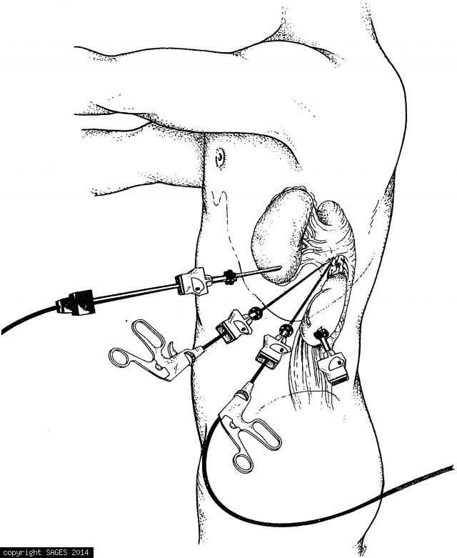 640x781 Stapler Tags