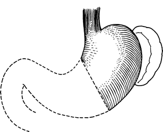320x259 Stomach Basicmedical Key