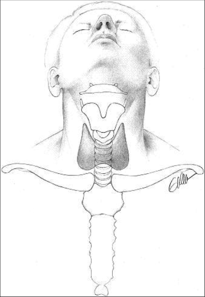 720x1041 Location Of The Thyroid Gland. From Surgery Of The Thyroid