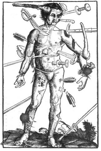 325x482 Medieval Medicine