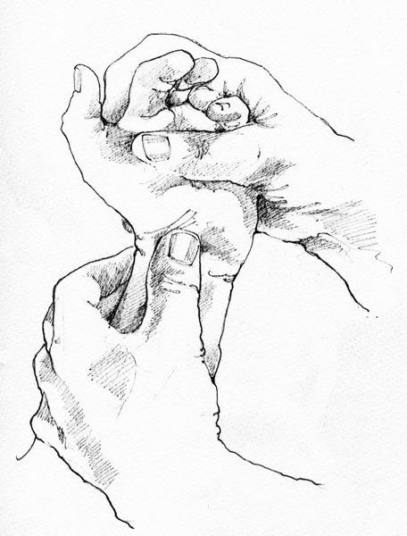 456x600 Overview Of Hand Surgery Mr Donald Sammut Frcs, Frcs, (Plast.)