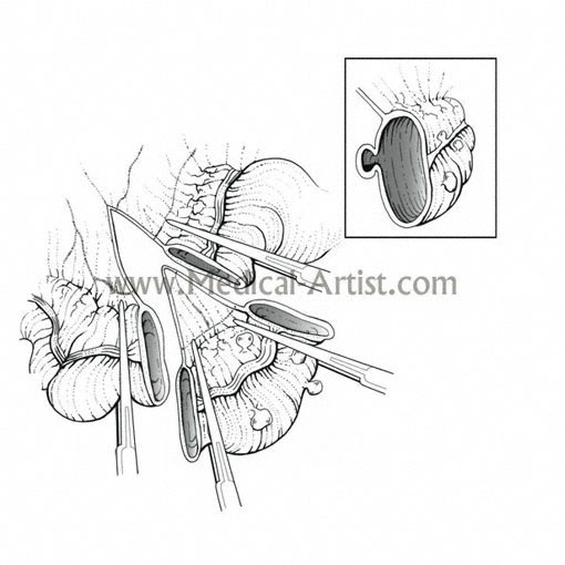 510x510 Traditional Pen And Ink Medical Illustrations Gallery Hand Draw