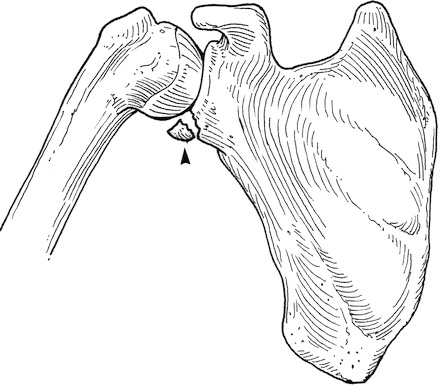 440x386 15 Best Anatomy Images On Anatomy Reference, Anatomy