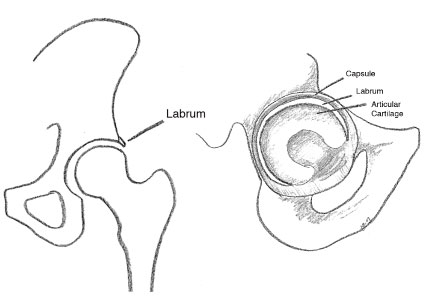 425x300 Labral Tear University Of Utah Health