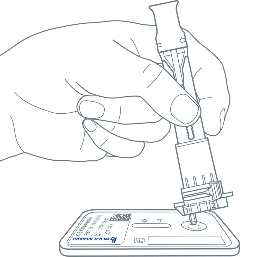 1000x1000 Calprotectin Home Test For Quantitative Determination Of Faecal