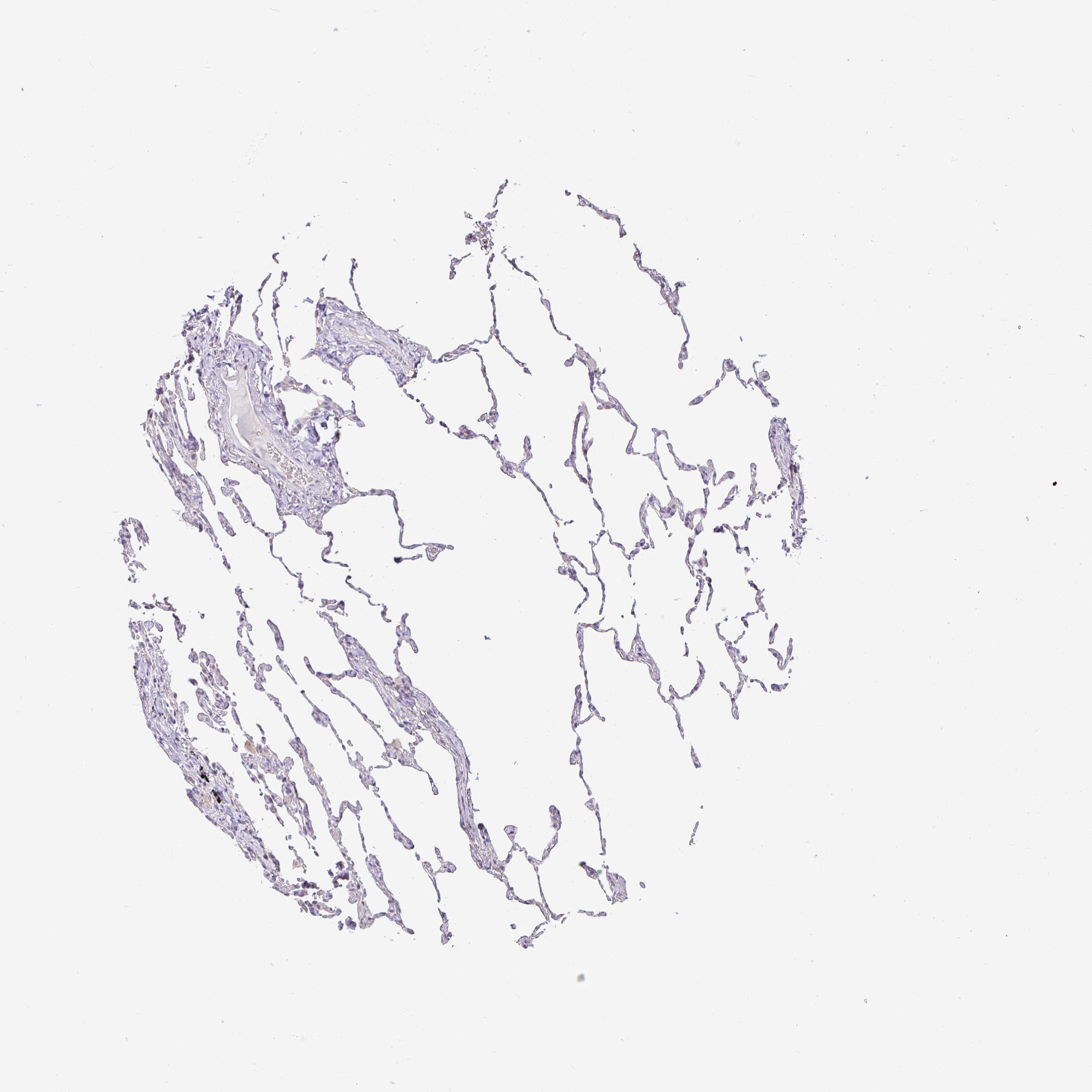 3000x3000 Tissue Expression Of Sirpa