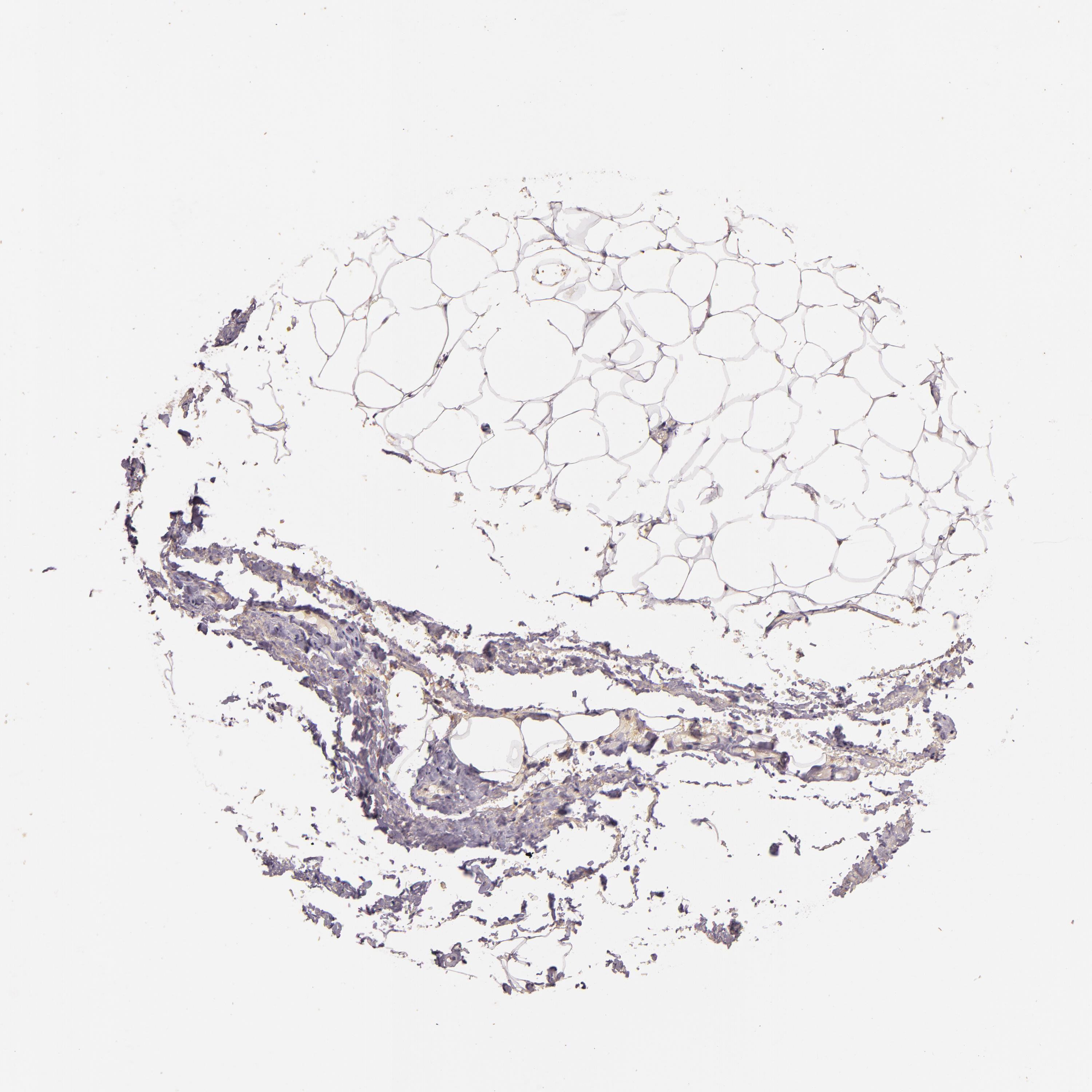 3000x3000 Tissue Expression Of Tff1