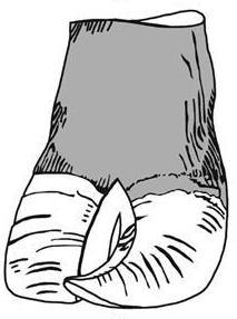 213x287 Curly Toe Syndrome Living The Country Life