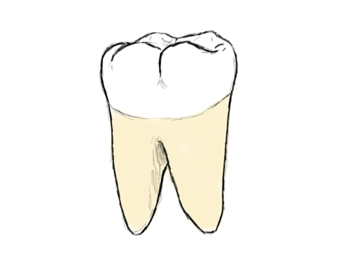 500x375 Everything You Ever Wanted To Know About Cavities