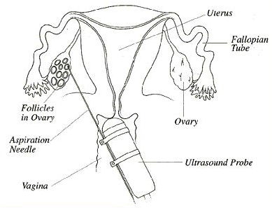 389x297 Ultrasound Life Of Travel