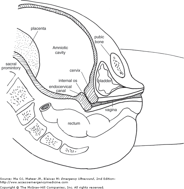 637x656 Chapter 13. Second And Third Trimester Pregnancy Emergency