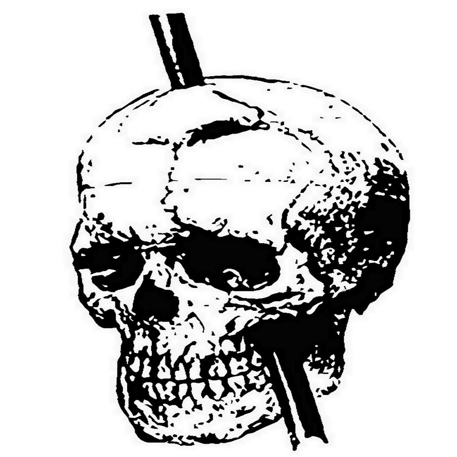 900x900 The Skull Of Phineas Gage Vintage Illustration Vector Painting By