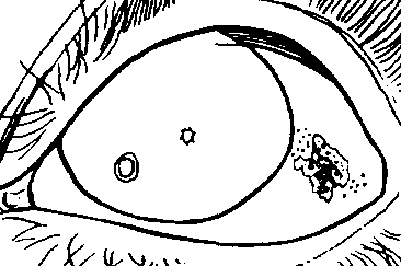 366x243 Session 30, Trainerttachment 30c Detectingnemiand Vitamin