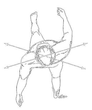 300x356 Over Pronated Feet Is An Arch Support The Answer