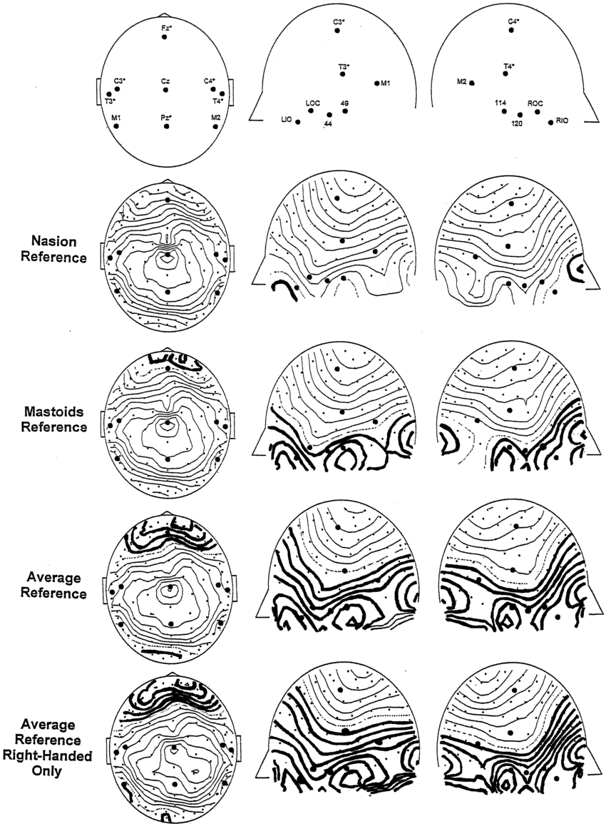 850x1158 Isovoltage Contour Maps