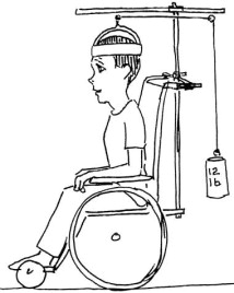 214x268 Creating A Halo Traction Wheelchair Resource Manual Using The Ebp