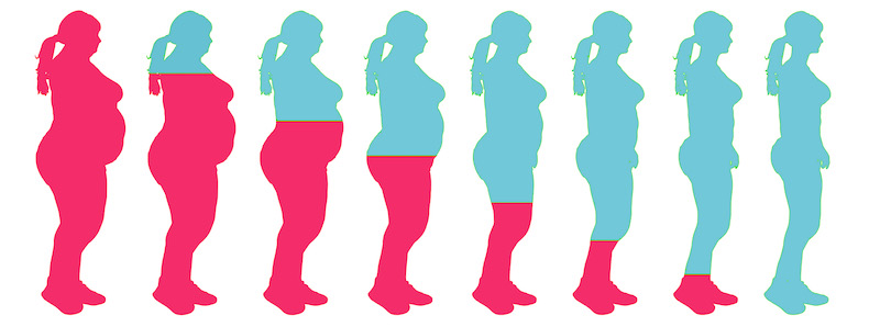 800x298 Gastric Sleeve Surgery All You Need To Know Ekachai Hospital