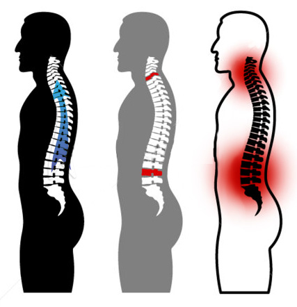 427x442 Spine Now! Sitio Oficial