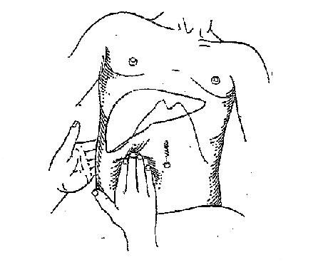 439x368 89 Best Abdominal Pictures Images On Nursing Schools