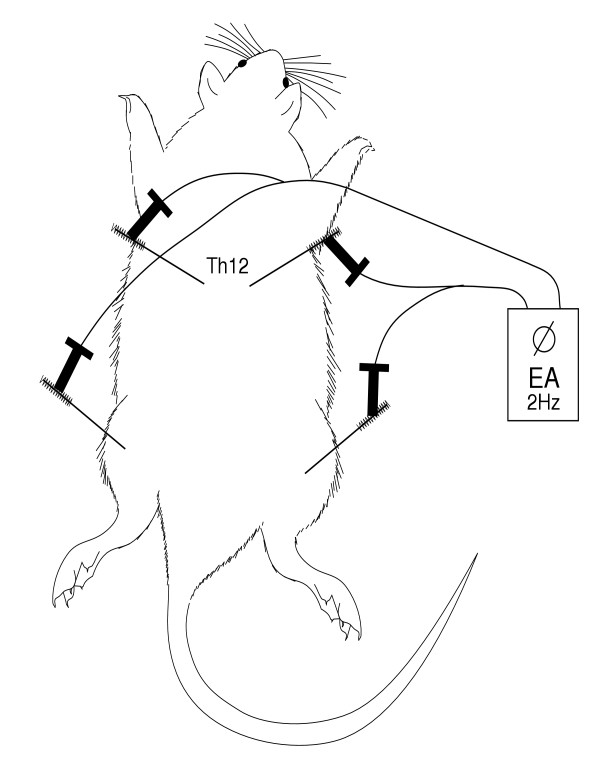 600x778 Schematic Drawing Placement And Stimulation