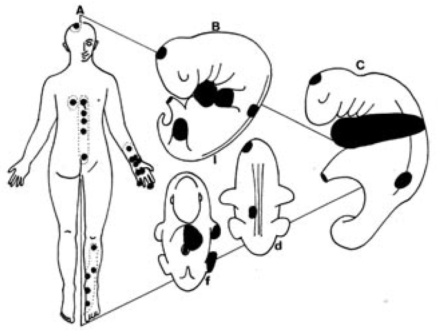 851x649 The Strange Circle In Kidney Channel