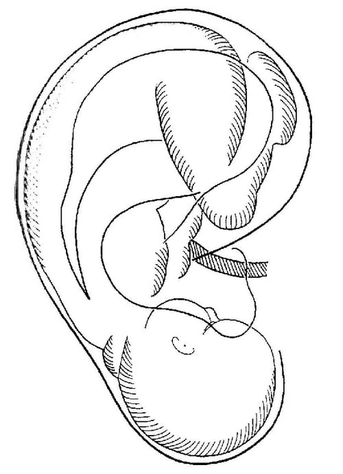 500x691 Auricular Acupuncture