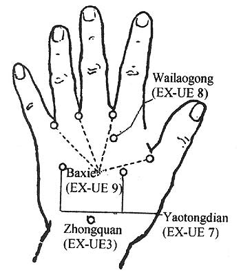 350x402 Bleeding Peripheral Points An Acupuncture Technique