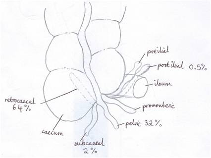 426x319 Pathsnip Appendicitis Ugpathsoc