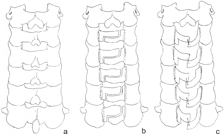 717x429 Schematic Drawing Showing The Posterior Aspect Of The Cervical