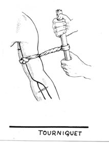 213x285 Tourniquet