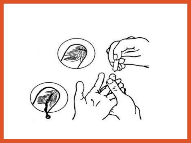 638x479 Blood Collection And Anticoagulants