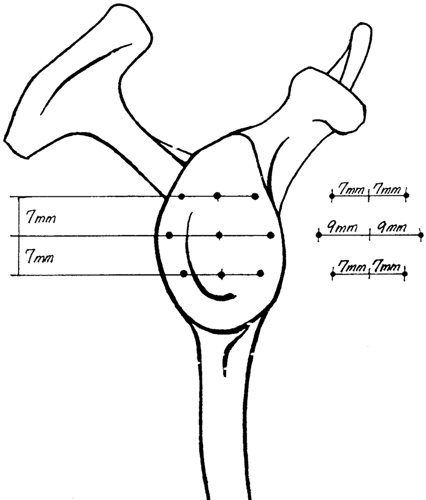 850x996 Schematic Drawing Of The Locations Of Measurement Of Cartilage