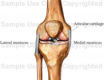400x306 Cartilage Of The Knee