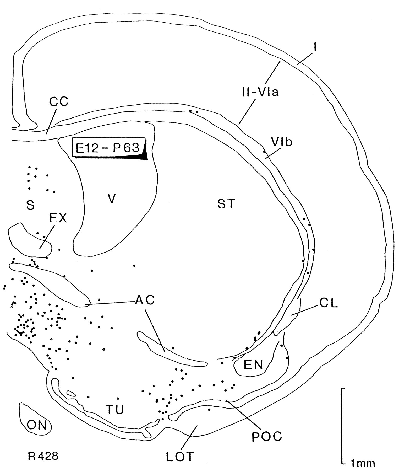 1523x1800 Dynamics Of Cell Migration From The Lateral Ganglionic Eminence