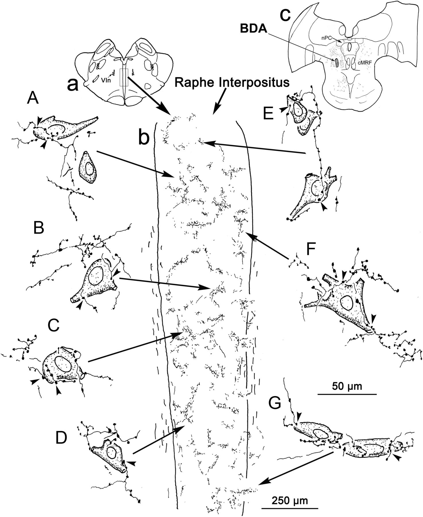 1473x1800 Anatomical Evidence That The Superior Colliculus Controls Saccades