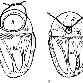 320x320 Tyge Sondergaard