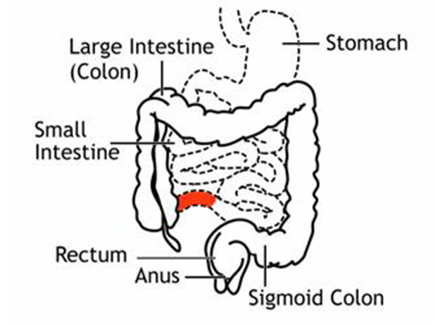 The best free Colon drawing images. Download from 44 free drawings of ...
