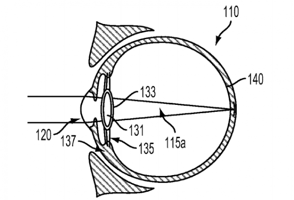 600x408 Google Seeks Patent For Implantable, Smart Intraocular Device