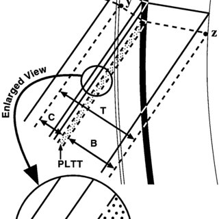 320x320 In The Model Eye Study Each Pmma Contact Lens Had The Same