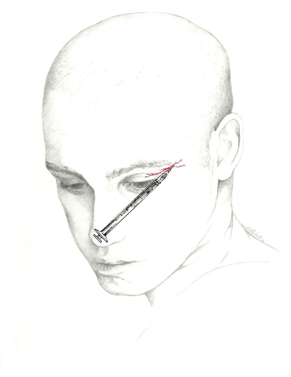 990x1282 Consensus Recommendations For Anaesthetic Peripheral Nerve Block