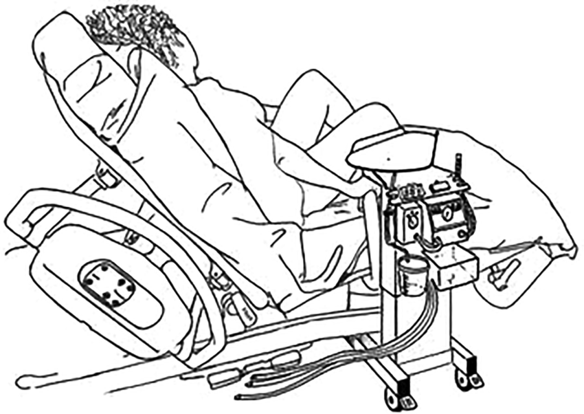850x602 Figure 3 Drawing Of The Trolley's Position For Normal Delivery