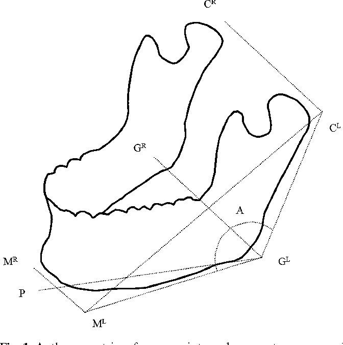 672x676 Determination Of Dimensions And Angles Of Mandible In The Fetal