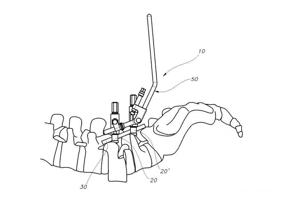 920x661 Medical Device
