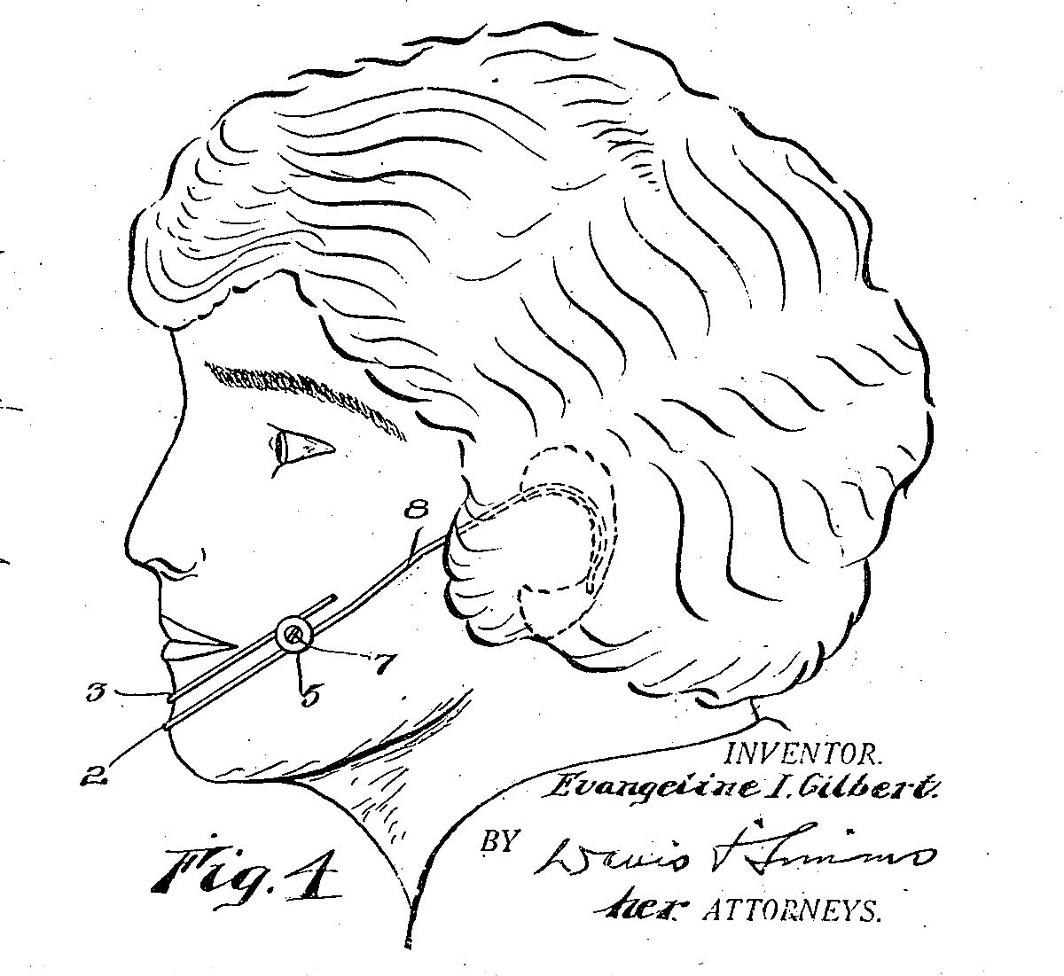 1200x1101 Dimple Machine Invention