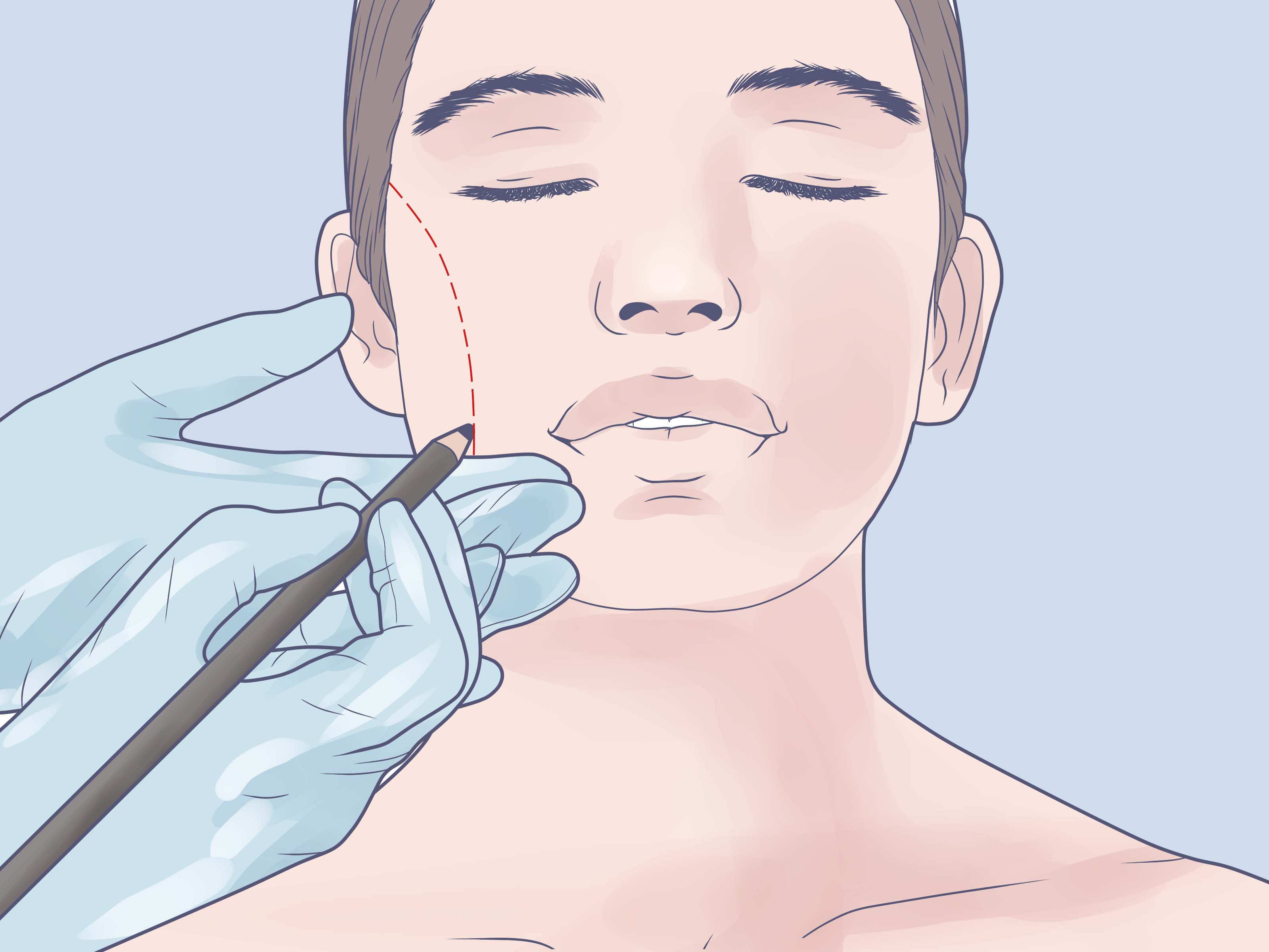 3200x2400 6 Easy Ways To Make Fake Dimples (With Pictures)
