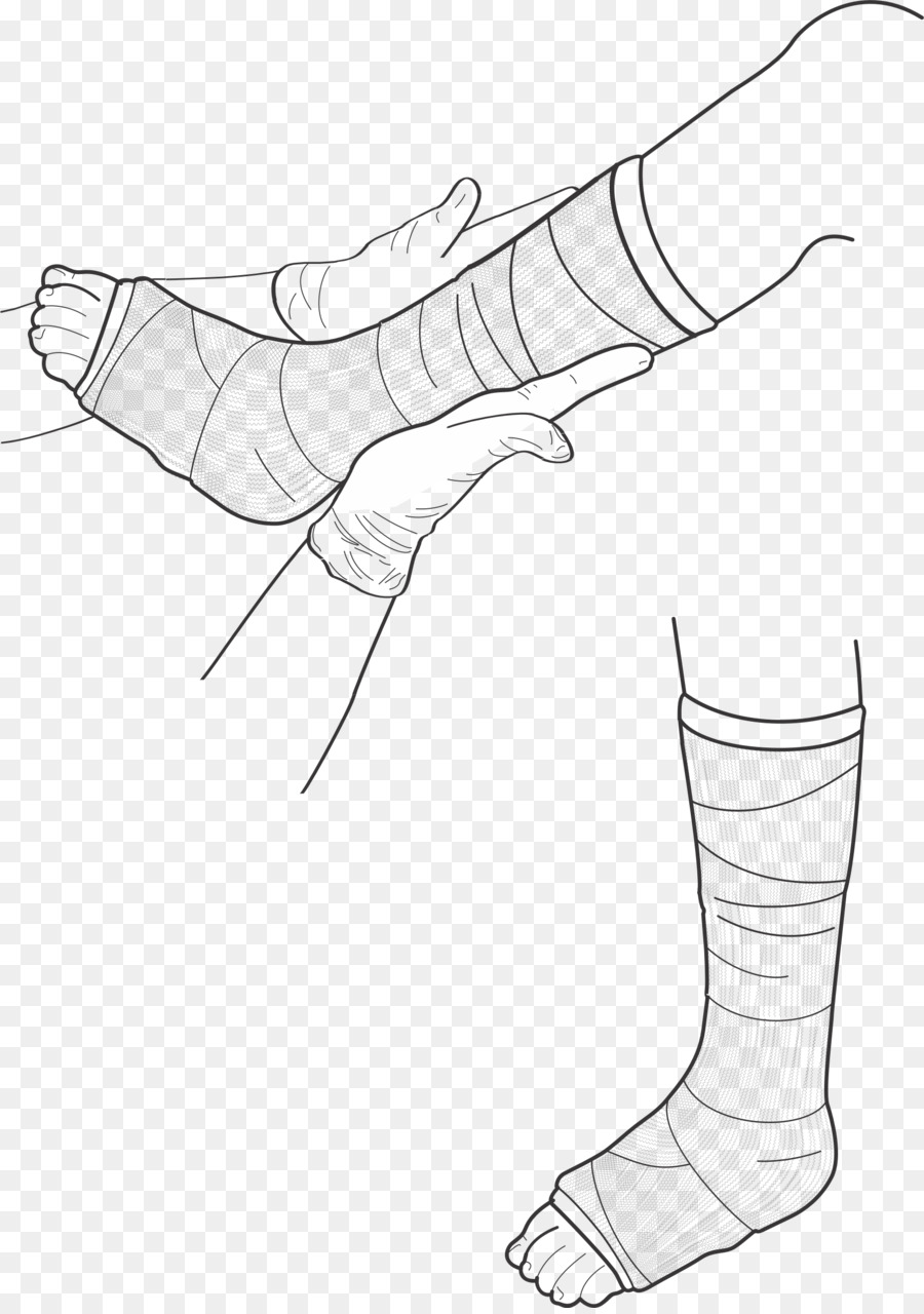 900x1280 Human Leg Drawing Orthopedic Cast Clip Art