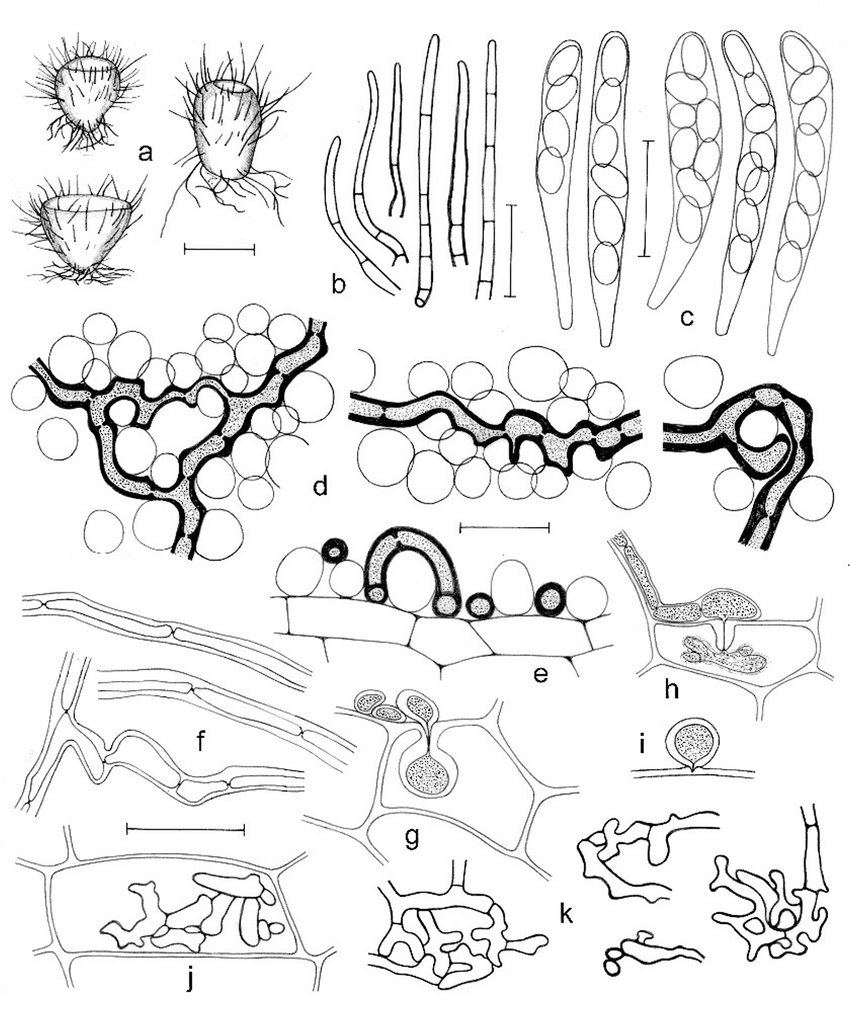850x1012 Octosporopsis Erinacea Pa'Lungan, Prm 945775). A. Apothecia