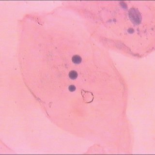 320x320 Mean Nuclear Diameter (Nd) And Nucleus Cytoplasm (Nc) Ratio