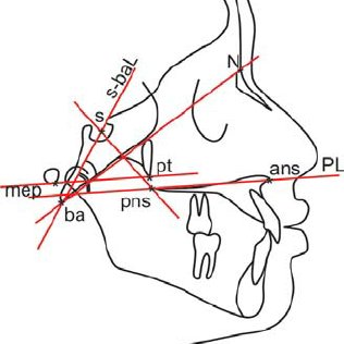 316x316 Reference Points, Linear And Angular Parameters Of This Study