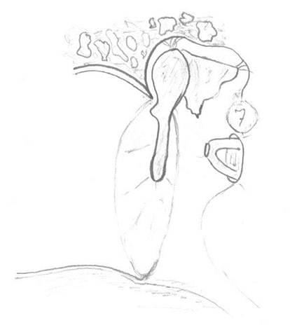 414x471 Middle Ear Surgery